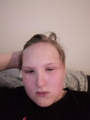 people call him the forehead man for a reason.