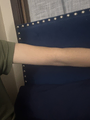 trevor's arm, which he was bullied into posting after fat allegations