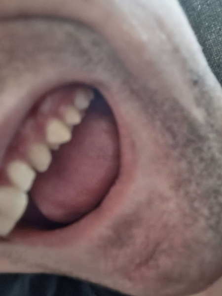 File:Dollfucker face 2.png