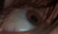xer eye... Idk